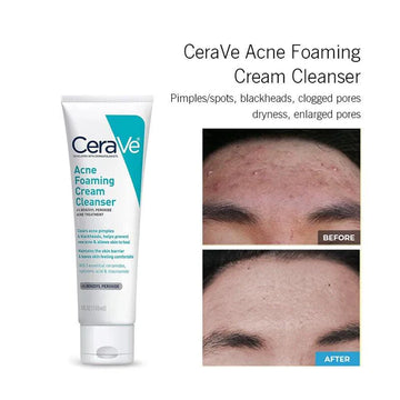 CeraVe 4 in 1 deal box - Includes Cleanser, SPF 50 Sunblock, Whitening Night Cream & Retinol Serum